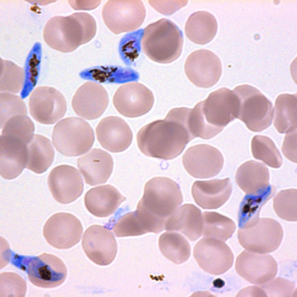 gametocyte