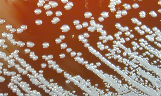 Burkholderia pseudomallei bacteria growth on a petri dish. CDC, Courtesy of Larry Stauffer, Oregon State Public Health Laboratory