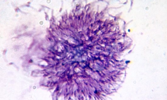 Plasmodium vivax sporozoites