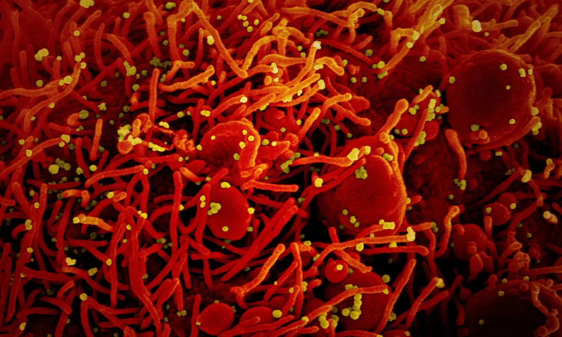 COVID19 Credit National Institute of Allergy and Infectious Diseases, NIH