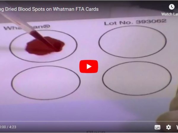 Making Dried Blood Spots on Whatman FTA Cards