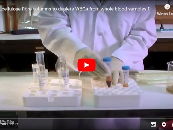 Using cellulose fibre columns to deplete WBCs from whole blood samples for genome sequencing