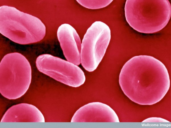 blood-credit-david-gregory-debbie-marshall-wellcome-images-b0004828_0.jpg