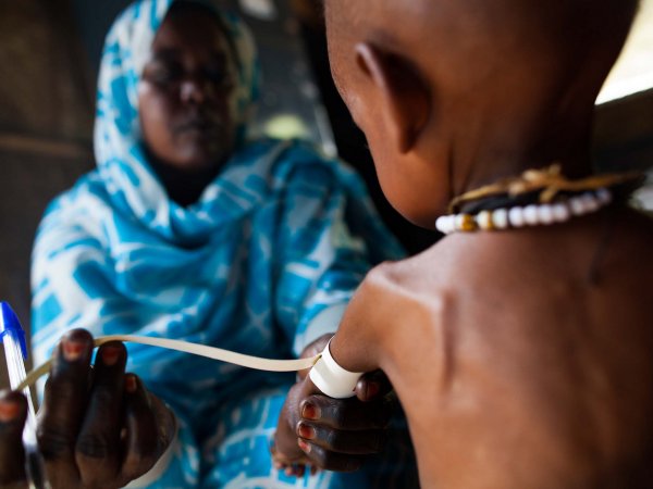 malnourished_child_darfur_albert-gonzalez-farran-unamid.jpg