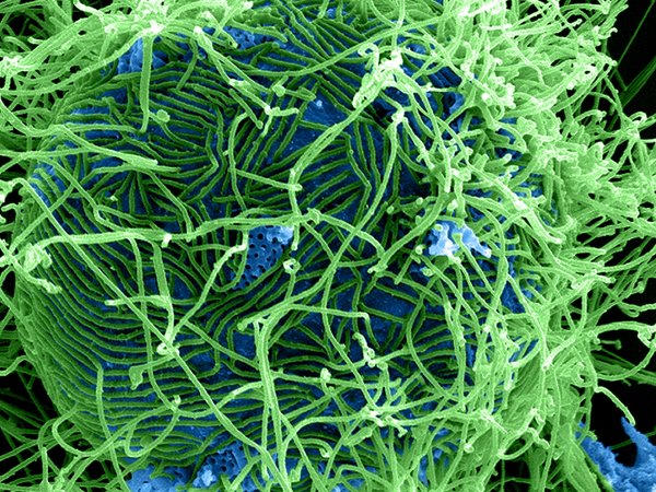Ebola Virus Particles (colourised SEM). Credit: National Institute of Allergy and Infectious Diseases, National Institutes of Health