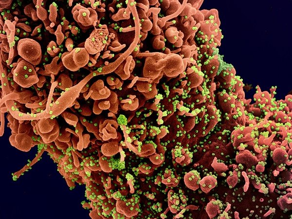 Colorized scanning electron micrograph of novel coronavirus SARS-CoV-2