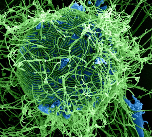 Ebola Virus Particles (colourised SEM). Credit: National Institute of Allergy and Infectious Diseases, National Institutes of Health