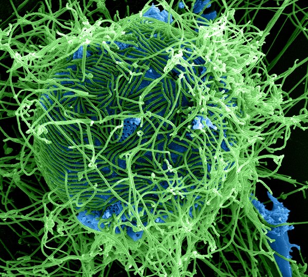 Particules du virus Ebola (MEB coloré). Crédit : Institut national des maladies allergiques et infectieuses, instituts nationaux de la santé (NIH)