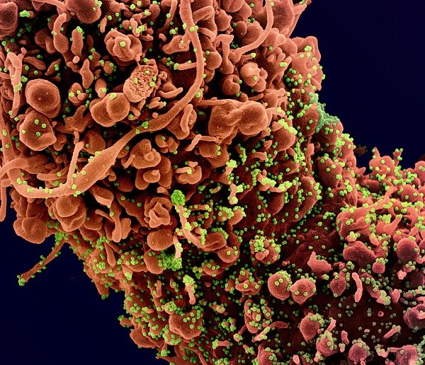Colorized scanning electron micrograph of novel coronavirus SARS-CoV-2