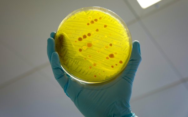 A variety of different bacteria - testing for AMR