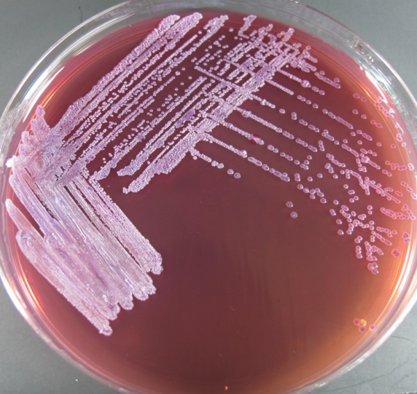Burkholderia pseudomallei bacteria growth on a petri dish. 