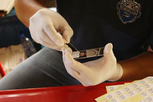 Testing blood for malaria