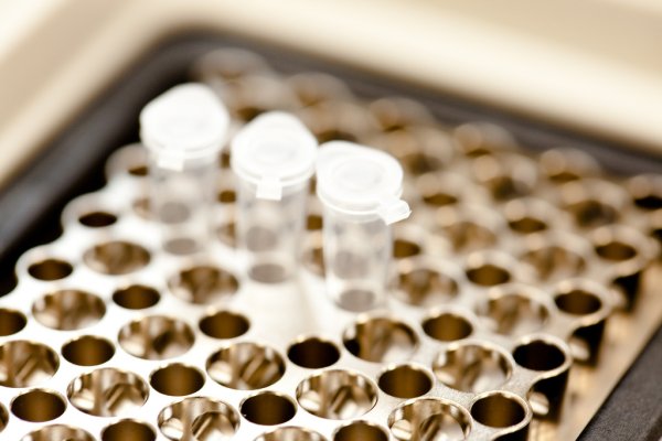 sample vials