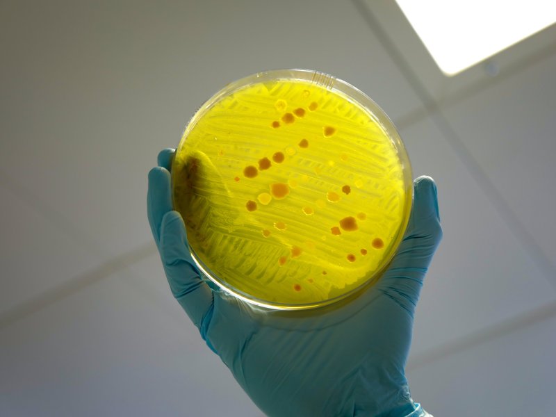 A variety of different bacteria - testing for AMR. Credit Will Crowne DFID