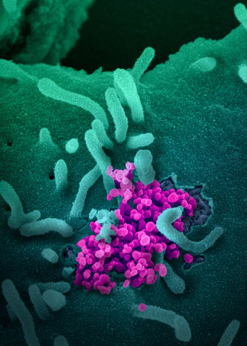 cov2causescovid19_pic4